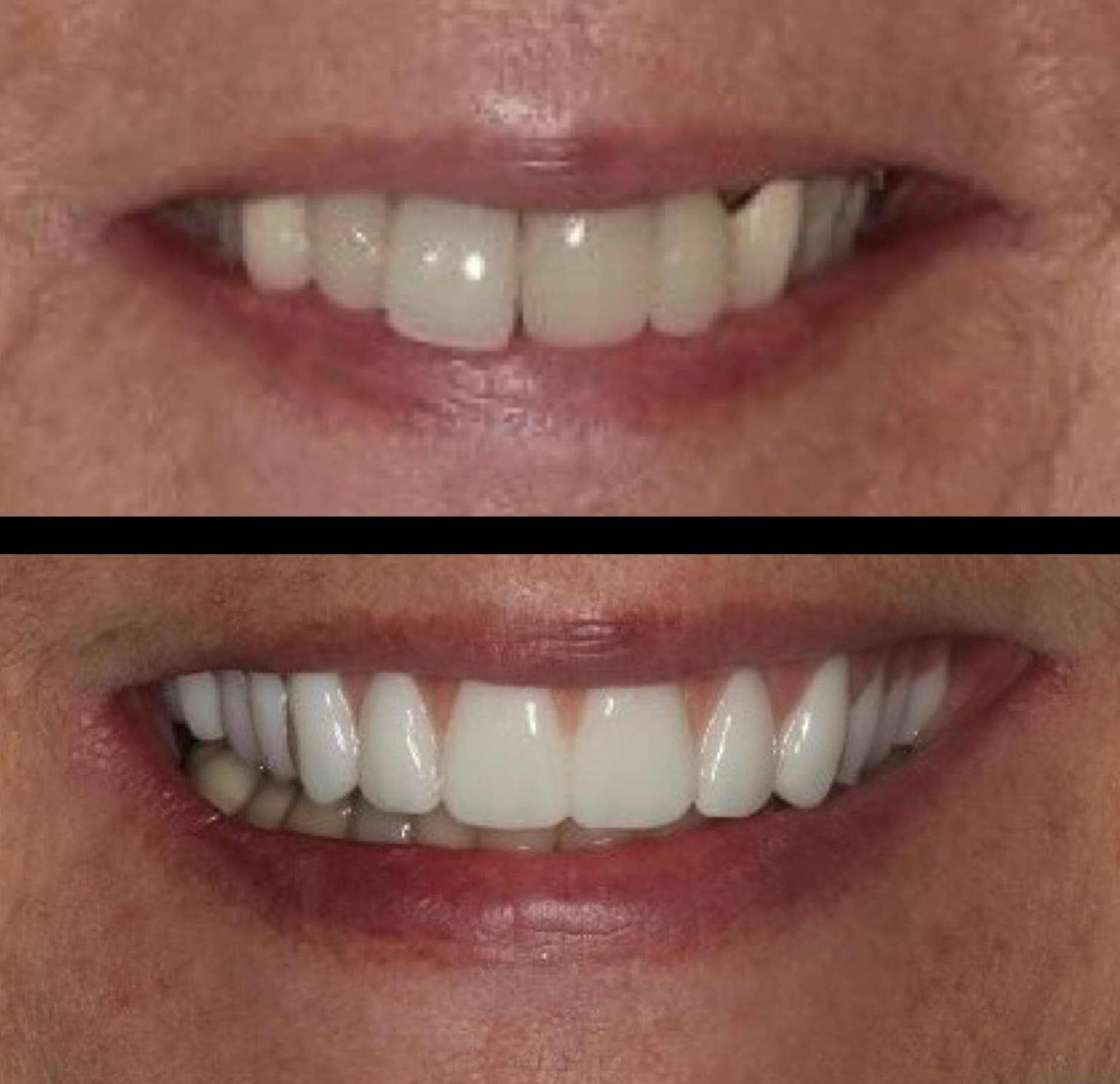 Before and after: full-mouth rehabilitation