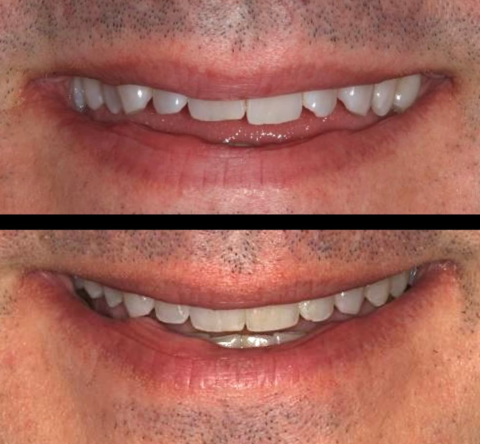 Before and after: orthodontic treatment