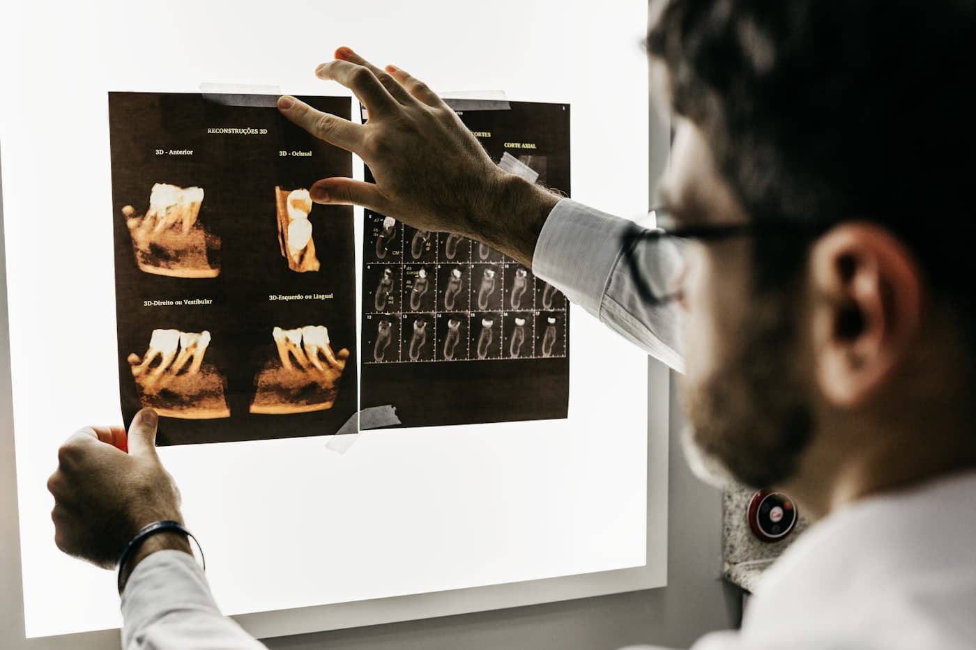 Surgical Dentistry in Decatur GA