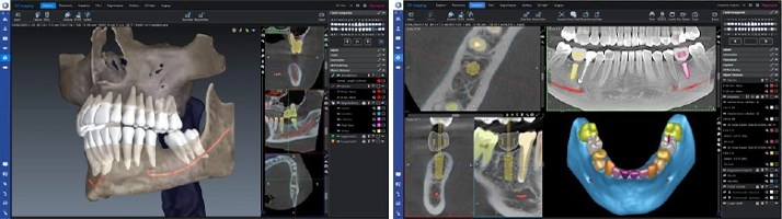 Example Of A High Tech CBCT Scan At Decatur Family Dental